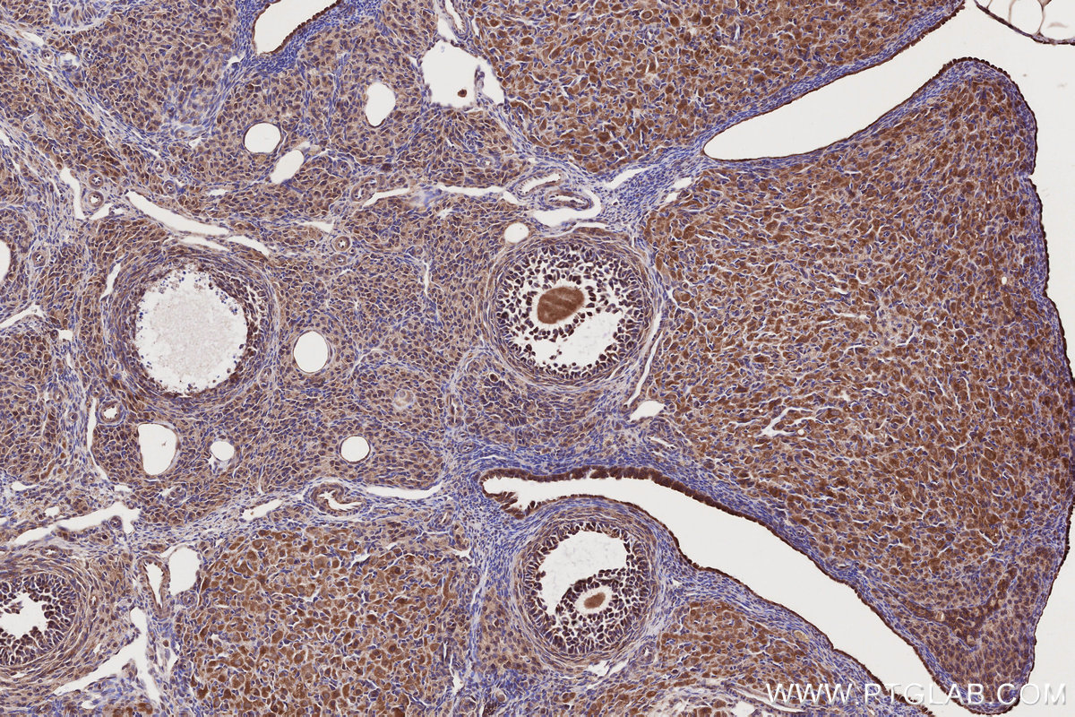 IHC staining of rat ovary using 11963-1-AP IHC staining of rat ovary using 11963-1-AP