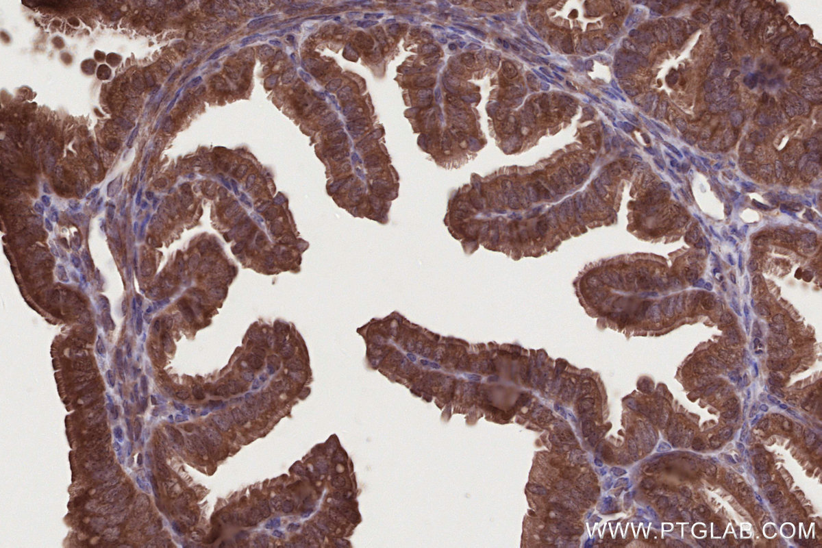 IHC staining of mouse ovary using 11963-1-AP IHC staining of mouse ovary using 11963-1-AP