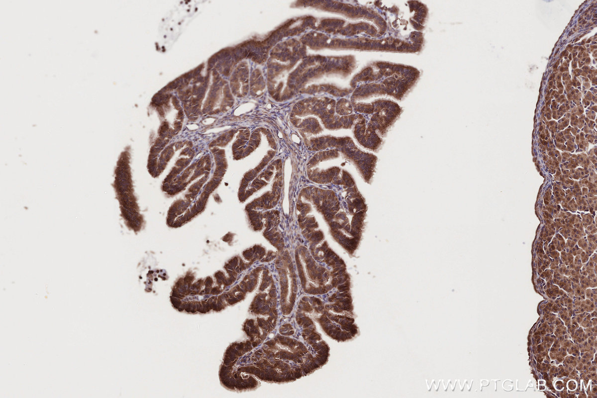 IHC staining of rat ovary using 11963-1-AP IHC staining of rat ovary using 11963-1-AP