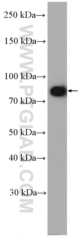 WB analysis of MCF-7 using 11963-1-AP