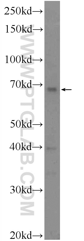 WB analysis of mouse kidney using 25222-1-AP