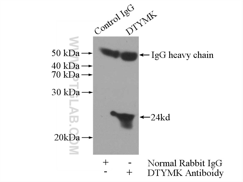 IP experiment of HeLa using 15360-1-AP