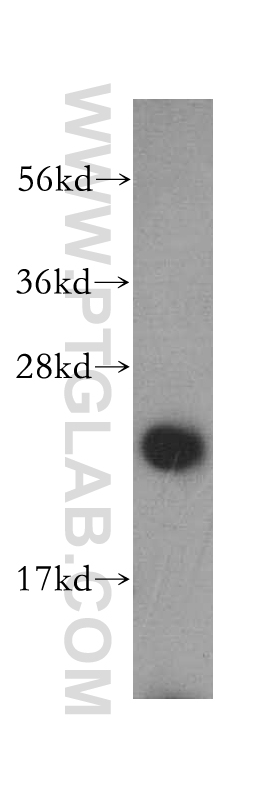 WB analysis of HeLa using 15360-1-AP