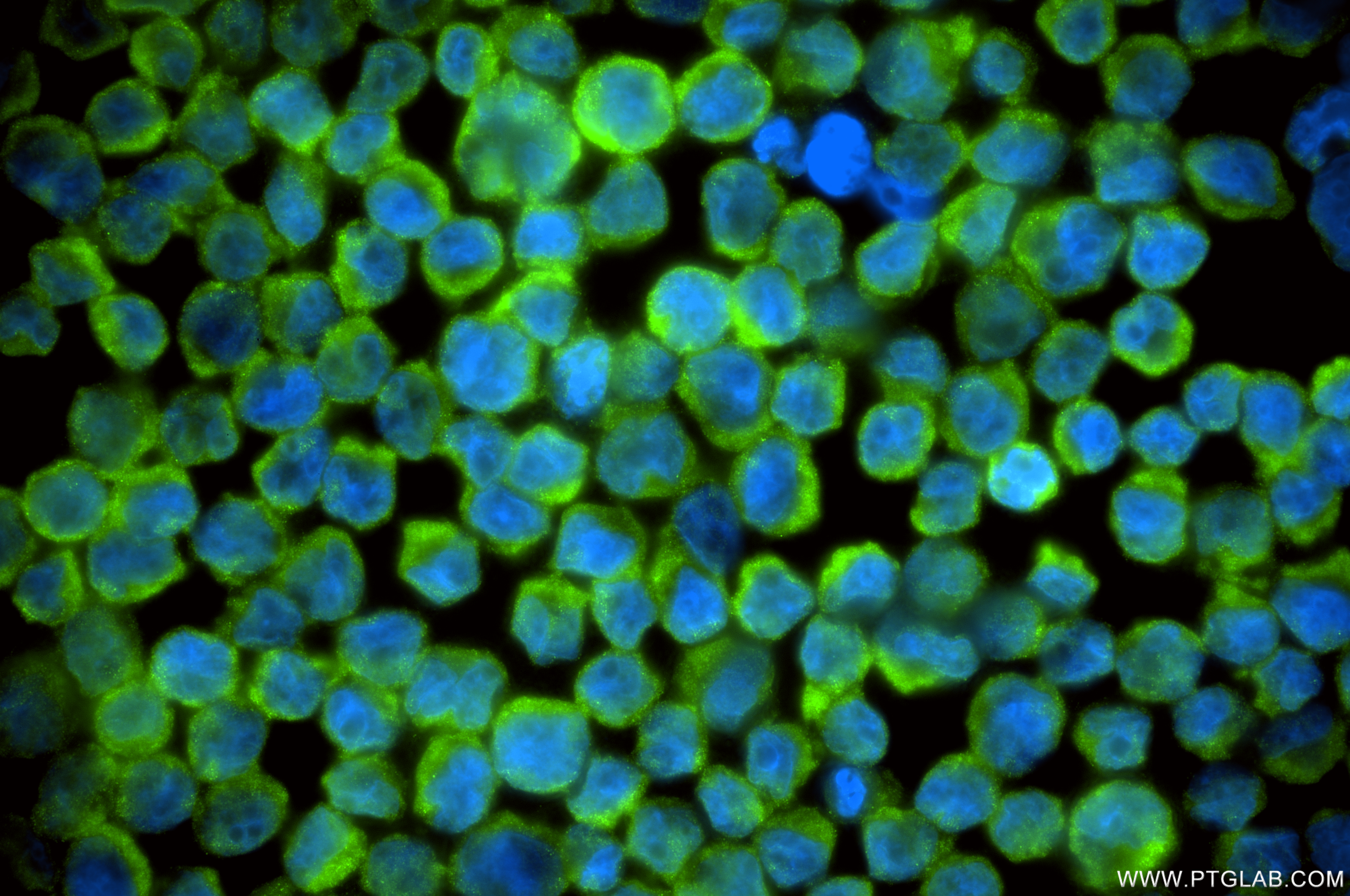 IF Staining of Raji using 86543-3-RR