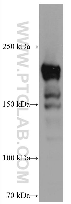 WB analysis of human testis using 67226-1-Ig