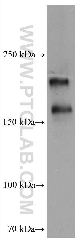 WB analysis of human placenta using 67226-1-Ig (same clone as 67226-1-PBS)