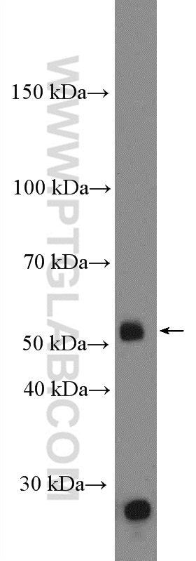 WB analysis of mouse colon using 26632-1-AP