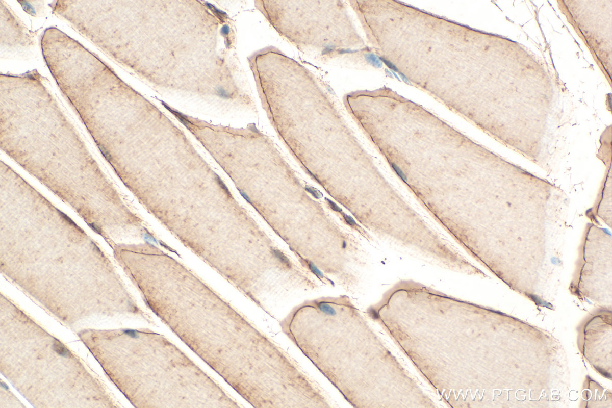 Immunohistochemical analysis of paraffin-embedded mouse skeletal muscle tissue slide using 25259-1-AP (DUPD1 / DUSP27 antibody) at dilution of 1:200 (under 40x lens). Heat mediated antigen retrieval with Tris-EDTA buffer (pH 9.0). IHC staining of mouse skeletal muscle using 25259-1-AP