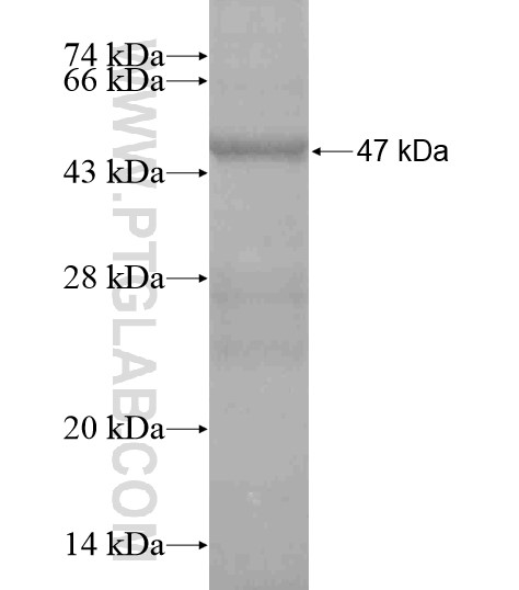 DUPD1 fusion protein Ag19640 SDS-PAGE DUPD1 fusion protein Ag19640 SDS-PAGE