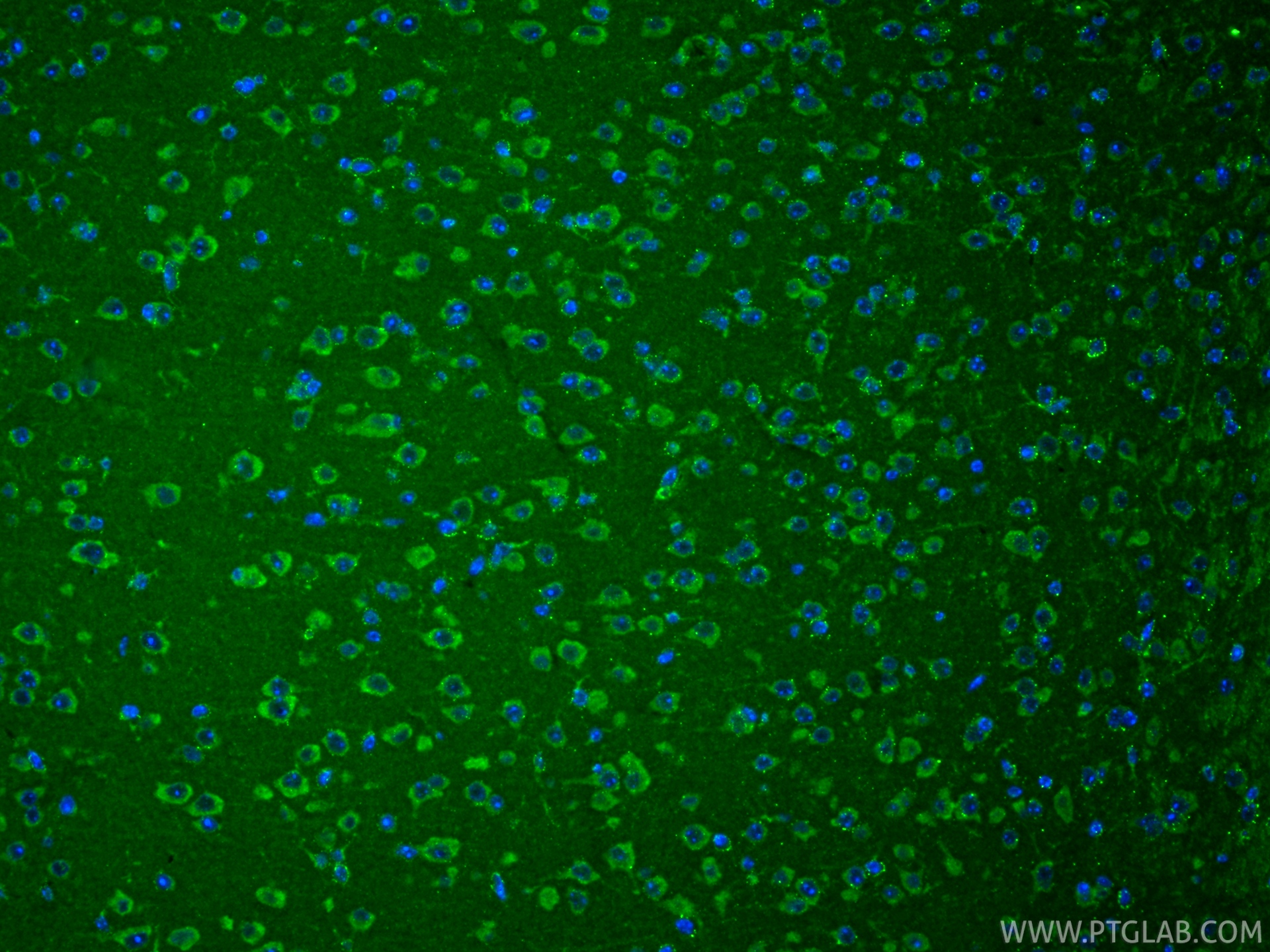 IF Staining of mouse brain using 83265-8-RR IF Staining of mouse brain using 83265-8-RR