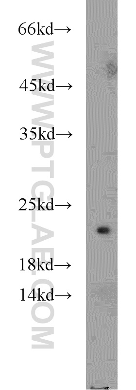 WB analysis of mouse kidney using 21870-1-AP