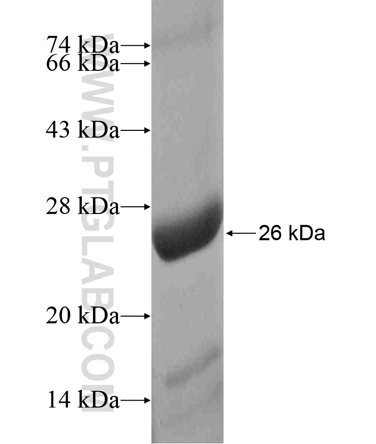 DUS4L fusion protein Ag17502 SDS-PAGE DUS4L fusion protein Ag17502 SDS-PAGE