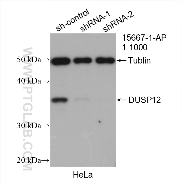 WB analysis of HeLa using 15667-1-AP