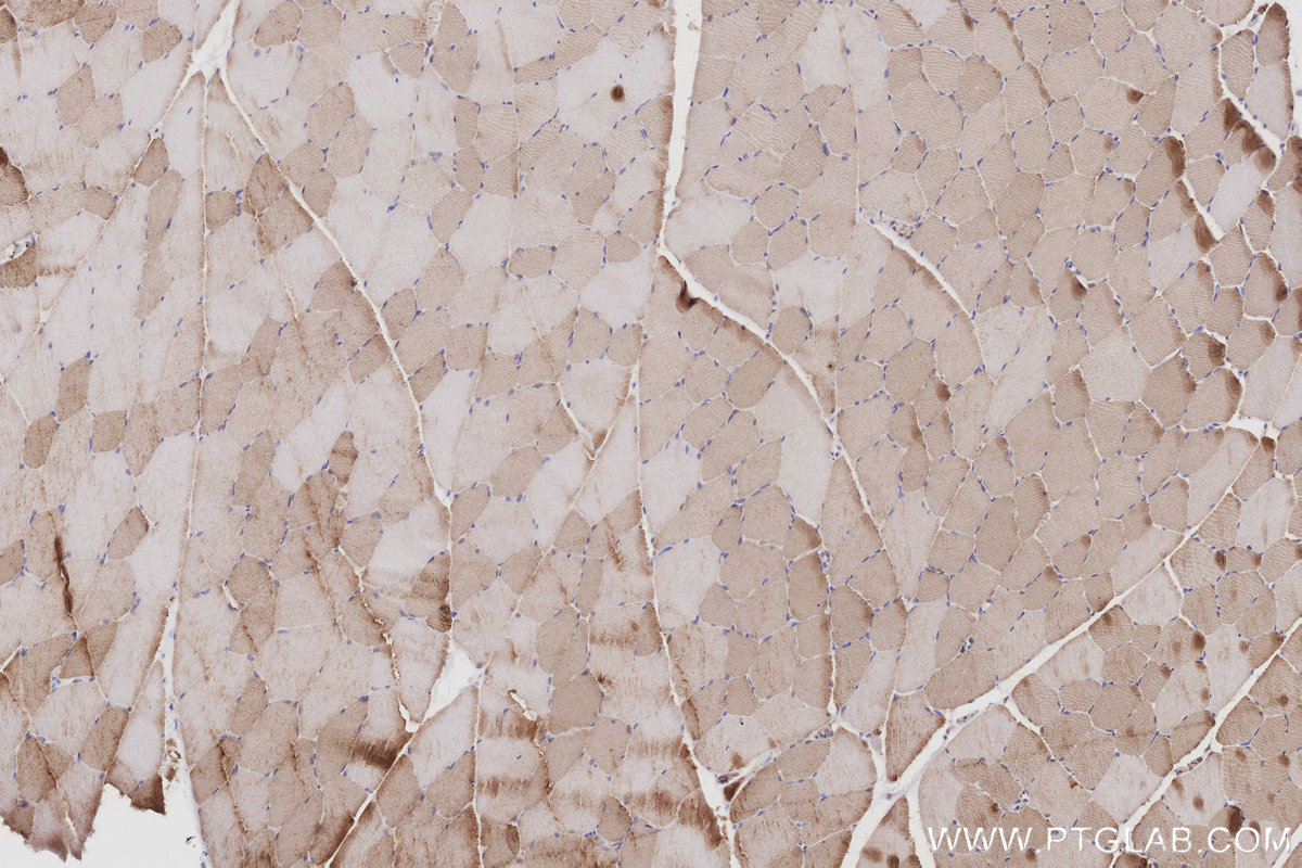 IHC staining of rat skeletal muscle using 10909-1-AP