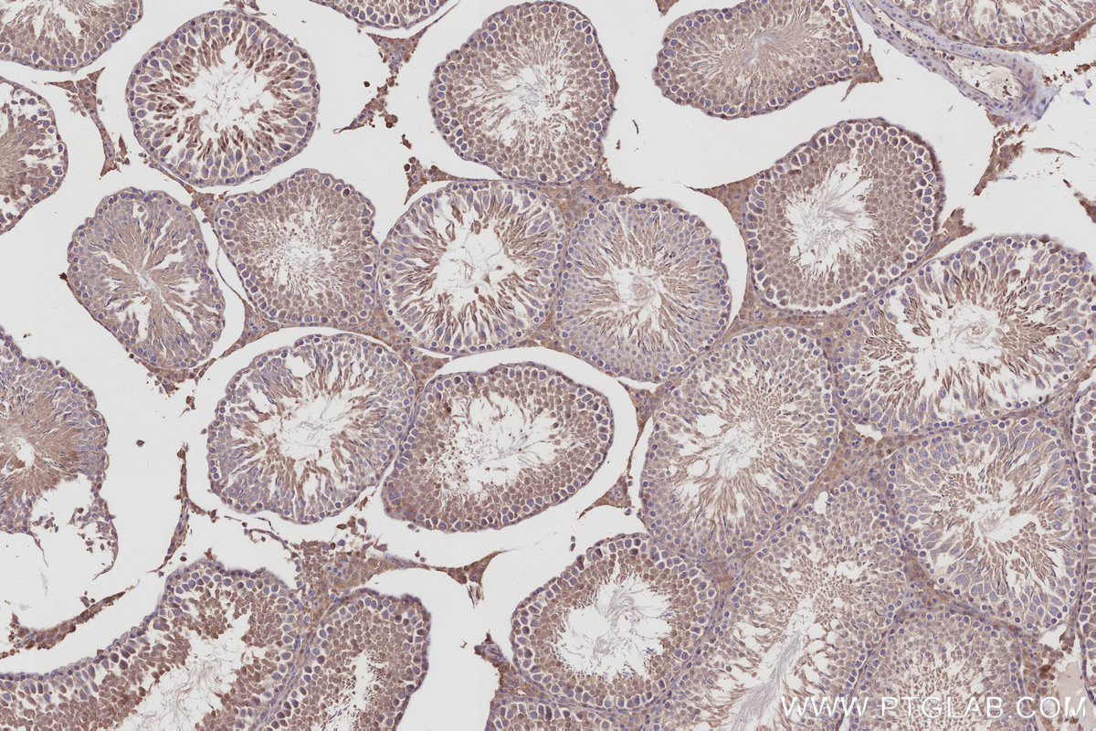 IHC staining of rat testis using 10909-1-AP