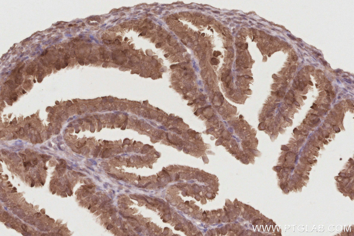 IHC staining of mouse ovary using 14237-1-AP