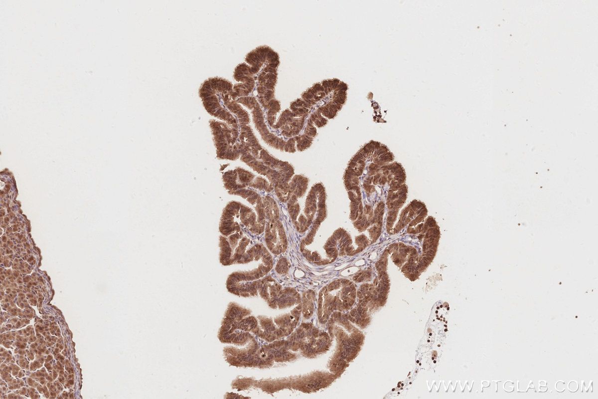 IHC staining of rat ovary using 14237-1-AP