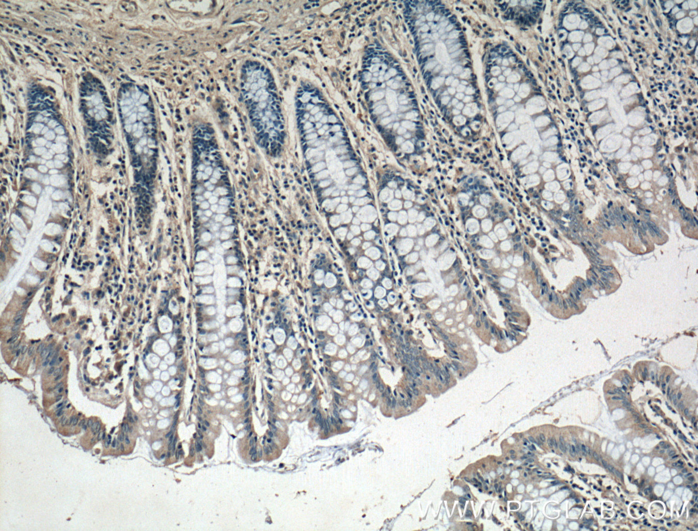 IHC staining of human colon using 14237-1-AP