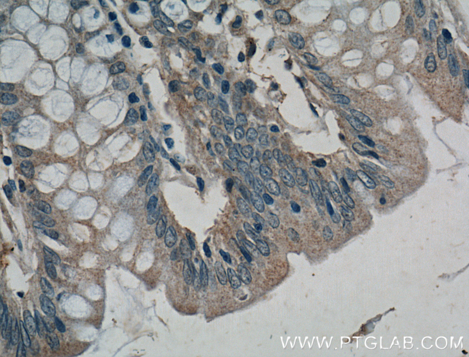 IHC staining of human colon using 14237-1-AP