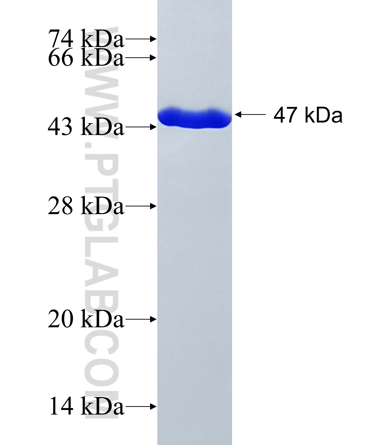 DUSP18 fusion protein Ag39857 SDS-PAGE DUSP18 fusion protein Ag39857 SDS-PAGE