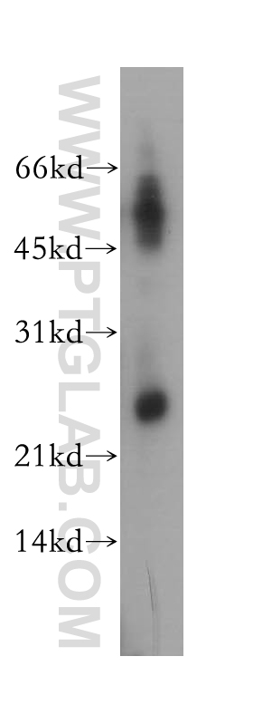 WB analysis of mouse uterus using 12924-1-AP