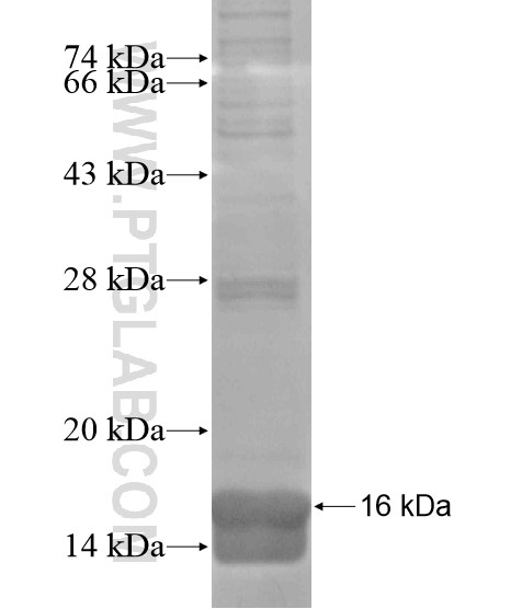 DUSP21 fusion protein Ag18636 SDS-PAGE