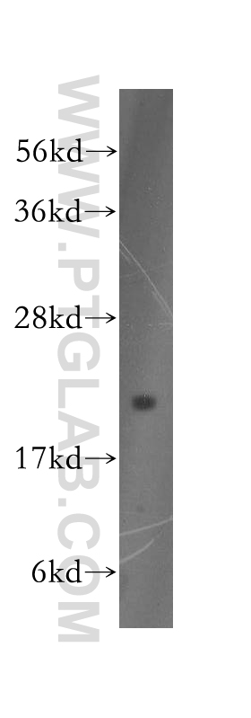 WB analysis of HEK-293 using 51005-2-AP