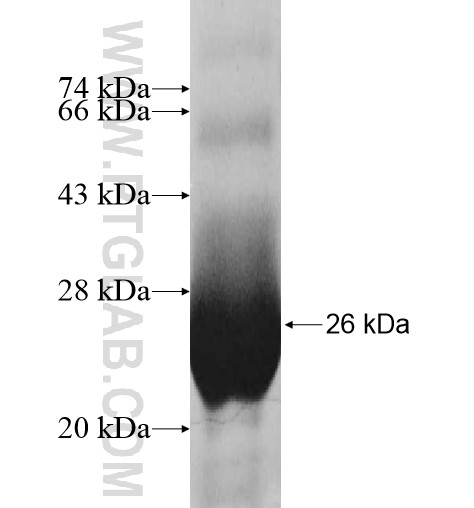 DUSP26 fusion protein Ag7974 SDS-PAGE DUSP26 fusion protein Ag7974 SDS-PAGE