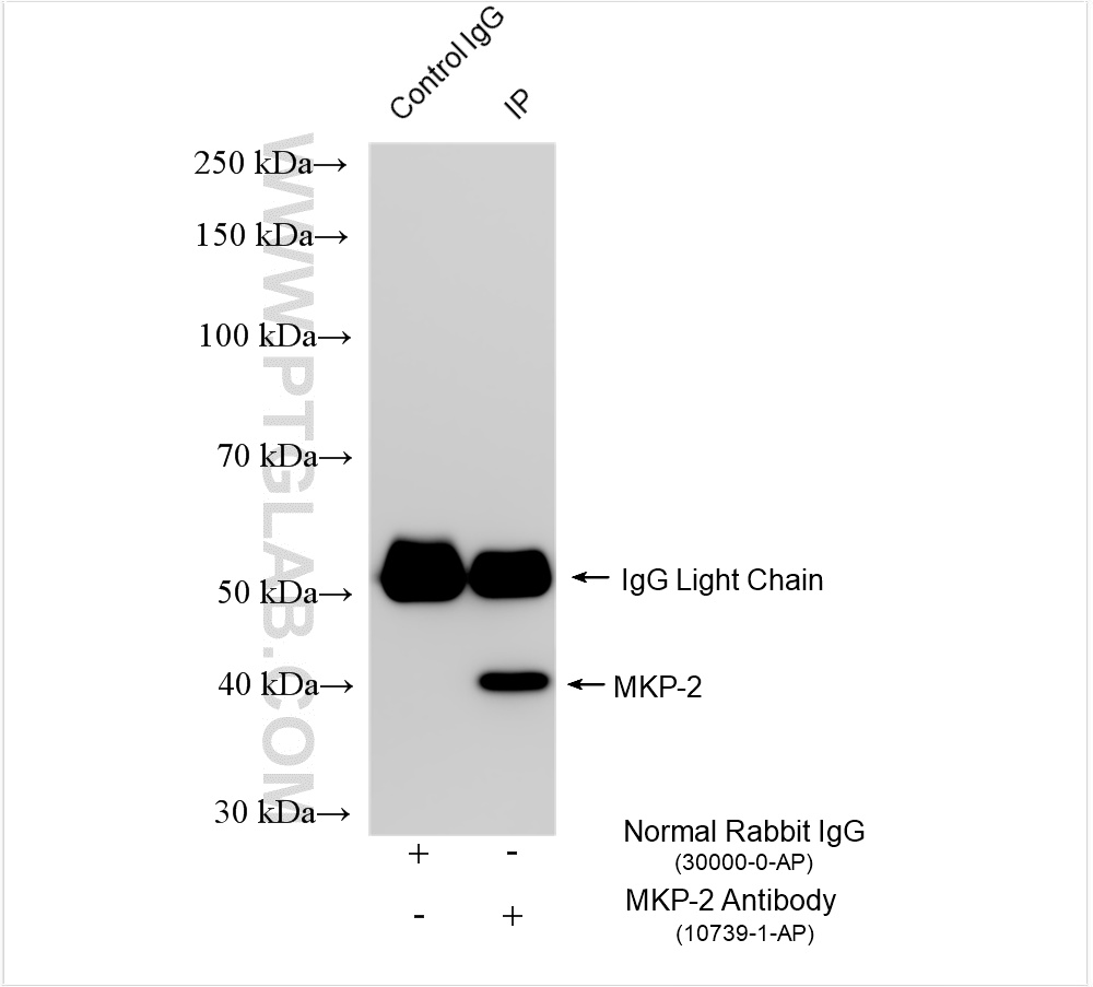 IP experiment of MDA-MB-231 using 10739-1-AP