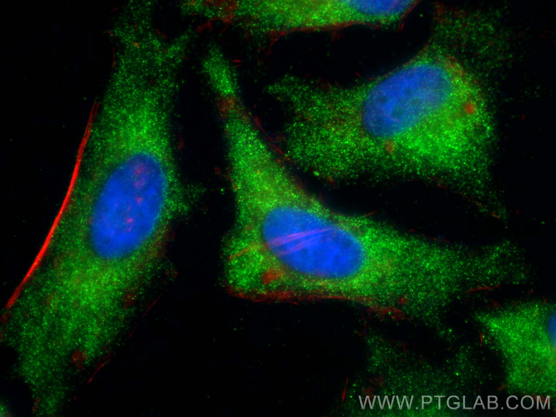 IF Staining of HeLa using 26071-1-AP