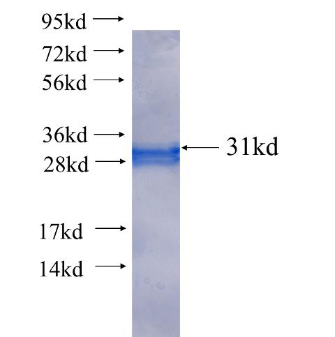 DUSP7 fusion protein Ag25488 SDS-PAGE