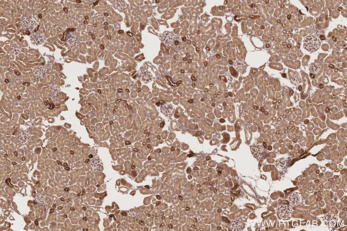 IHC staining of mouse kidney using 26718-1-AP IHC staining of mouse kidney using 26718-1-AP