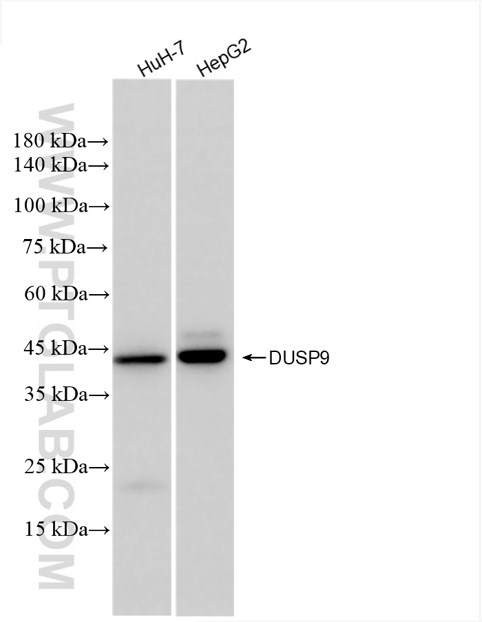 WB analysis using 86199-3-RR