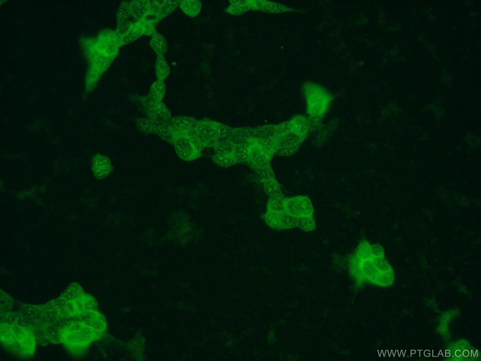 IF Staining of HEK-293 using 13740-1-AP