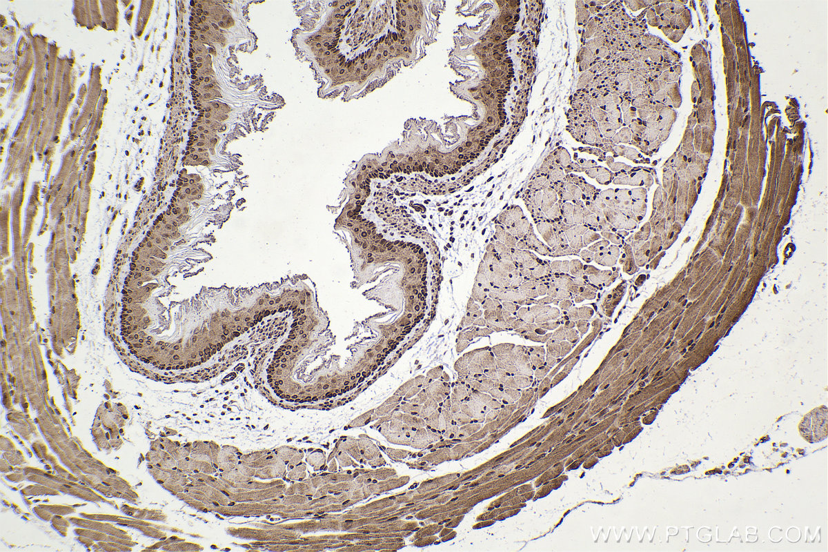 IHC staining of mouse esophagus using 13740-1-AP IHC staining of mouse esophagus using 13740-1-AP