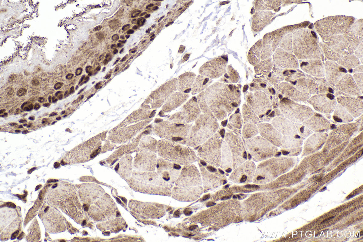 IHC staining of mouse esophagus using 13740-1-AP IHC staining of mouse esophagus using 13740-1-AP