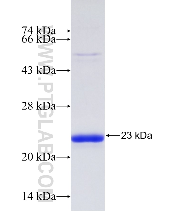 DUT fusion protein Ag30799 SDS-PAGE DUT fusion protein Ag30799 SDS-PAGE