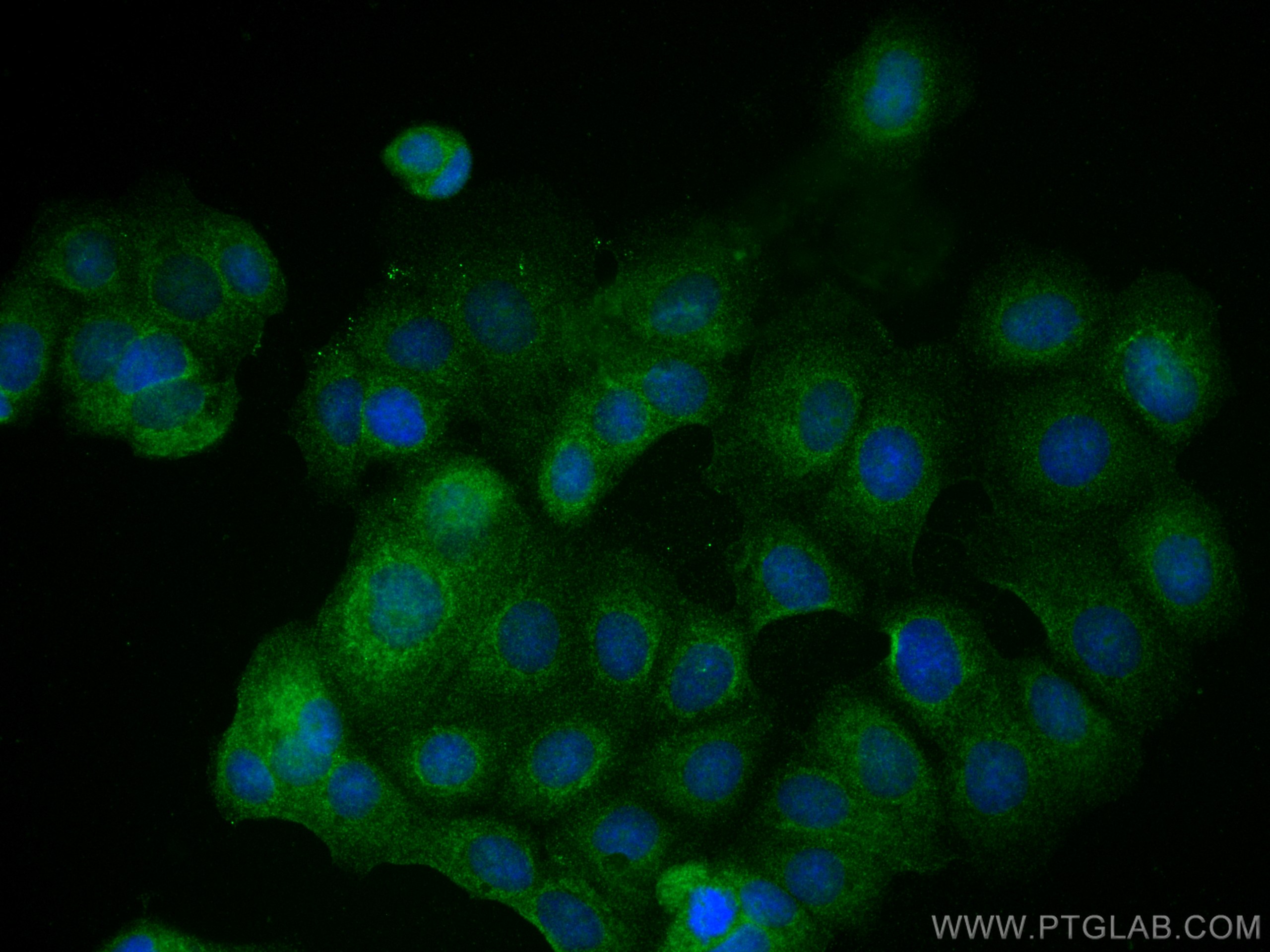 IF Staining of MCF-7 using 27384-1-AP