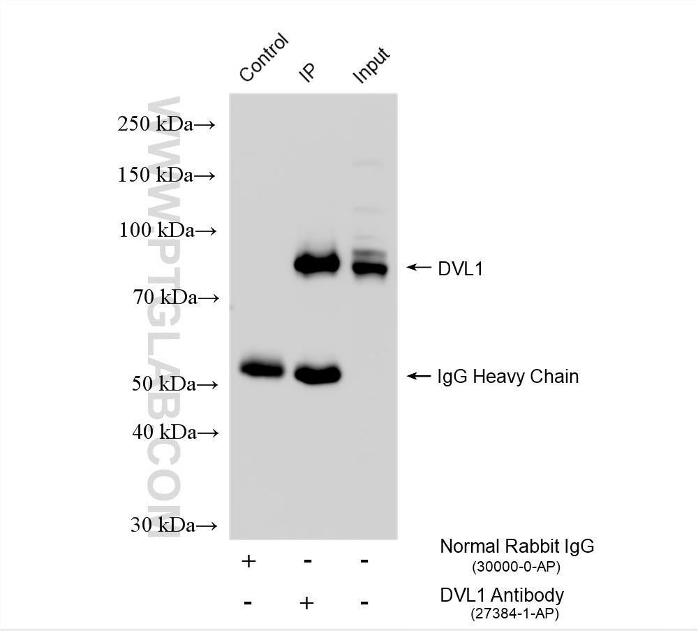 IP experiment of HEK-293 using 27384-1-AP