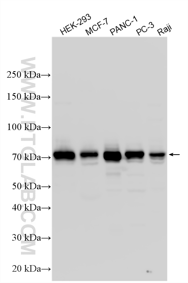 WB analysis using 27384-1-AP