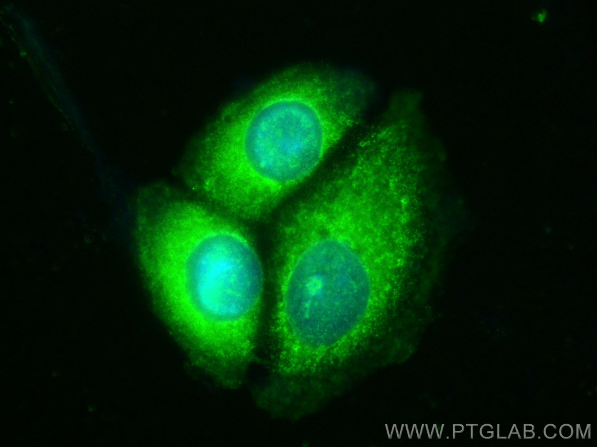 IF Staining of MCF-7 using CL488-67672