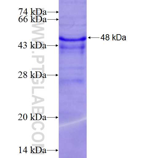 DVL1 fusion protein Ag5718 SDS-PAGE DVL1 fusion protein Ag5718 SDS-PAGE