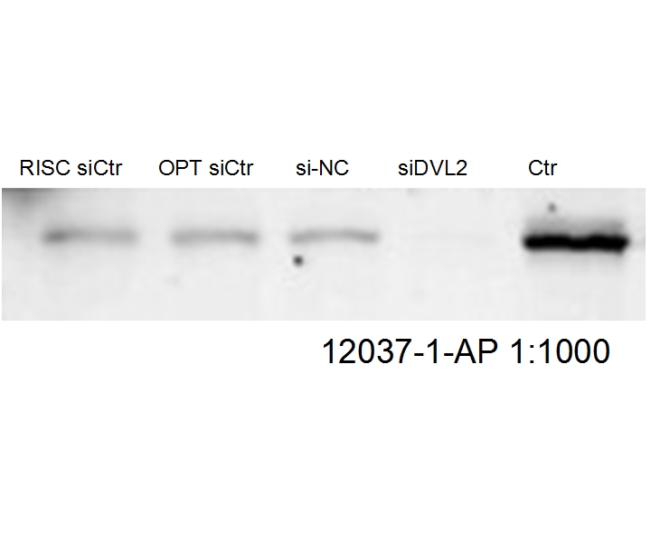 WB analysis of HepG2 cells using 12037-1-AP