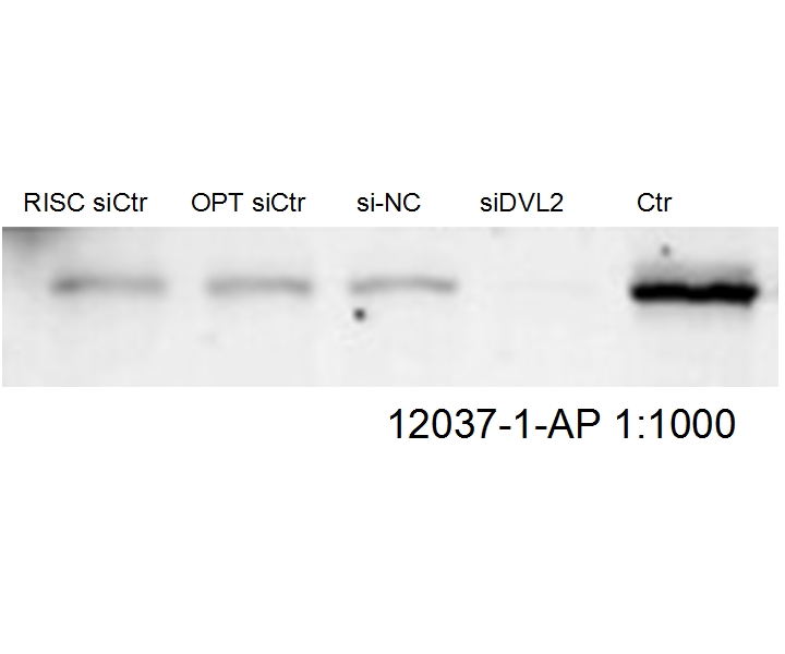 DVL2 Polyclonal antibody