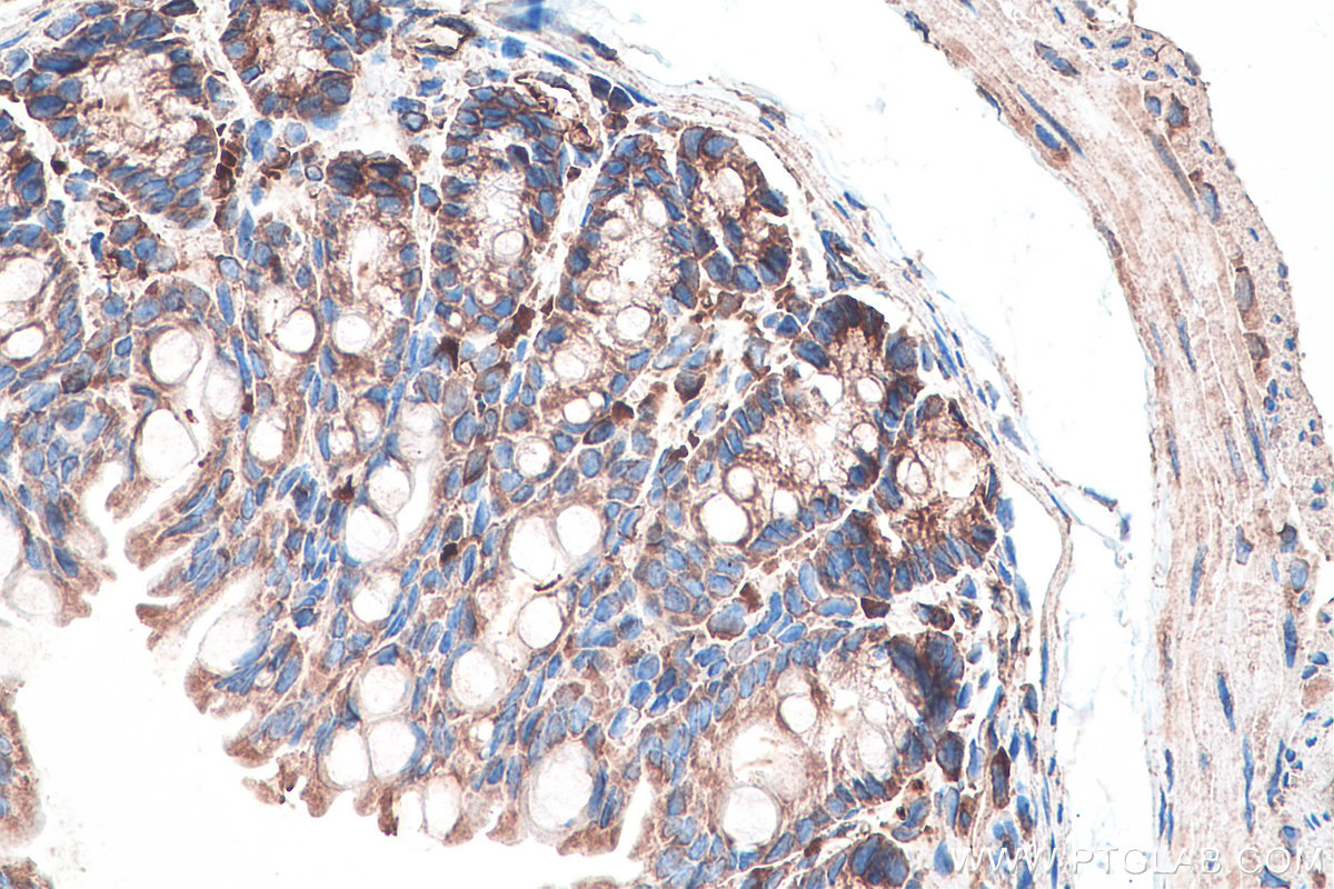 IHC staining of mouse colon using 67105-1-Ig