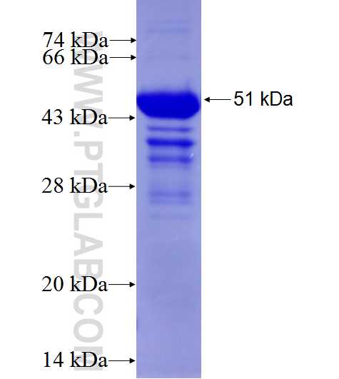DVL3 fusion protein Ag4451 SDS-PAGE DVL3 fusion protein Ag4451 SDS-PAGE