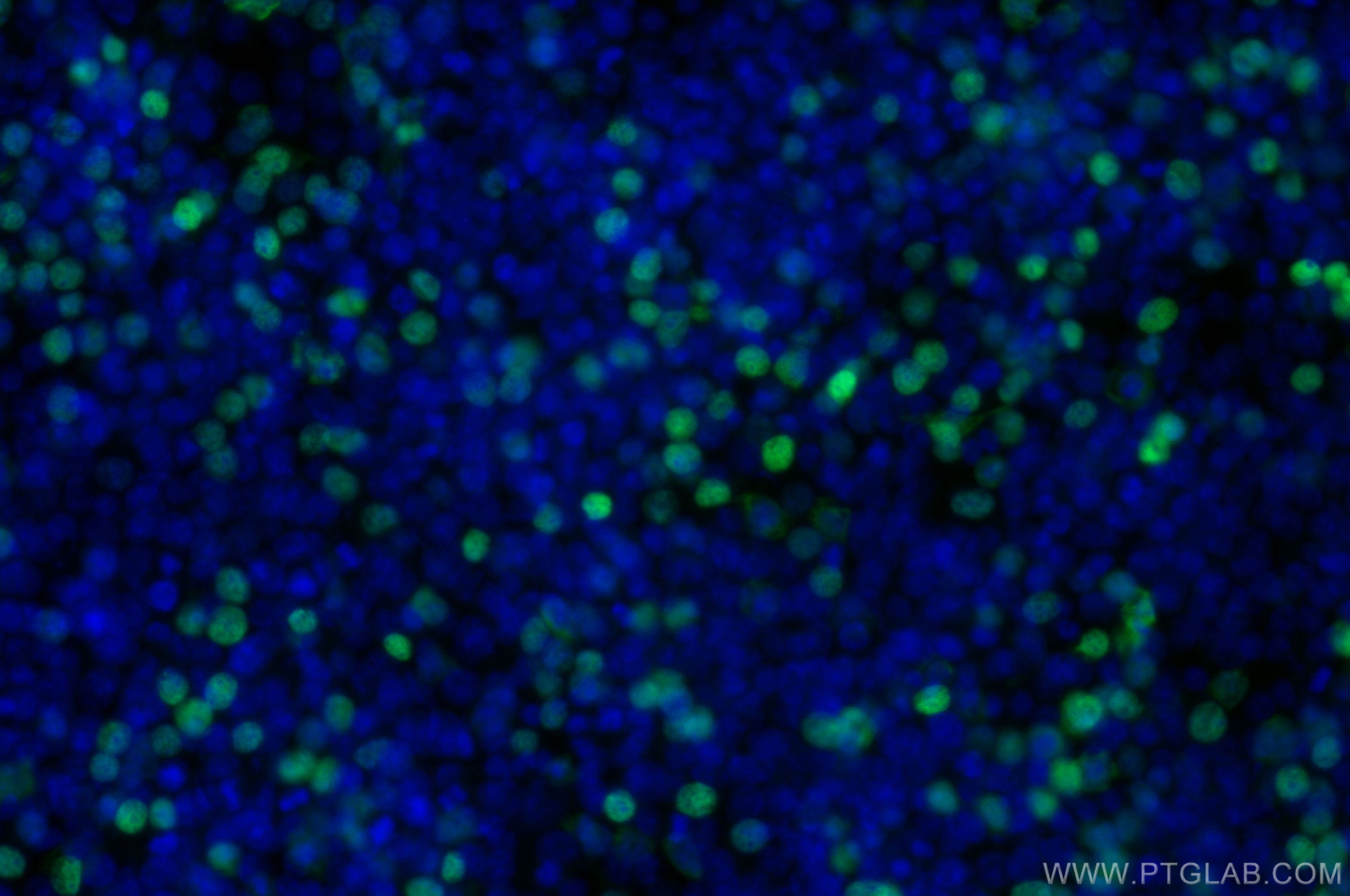 IF Staining of Transfected HEK-293 using CL488-80801-2