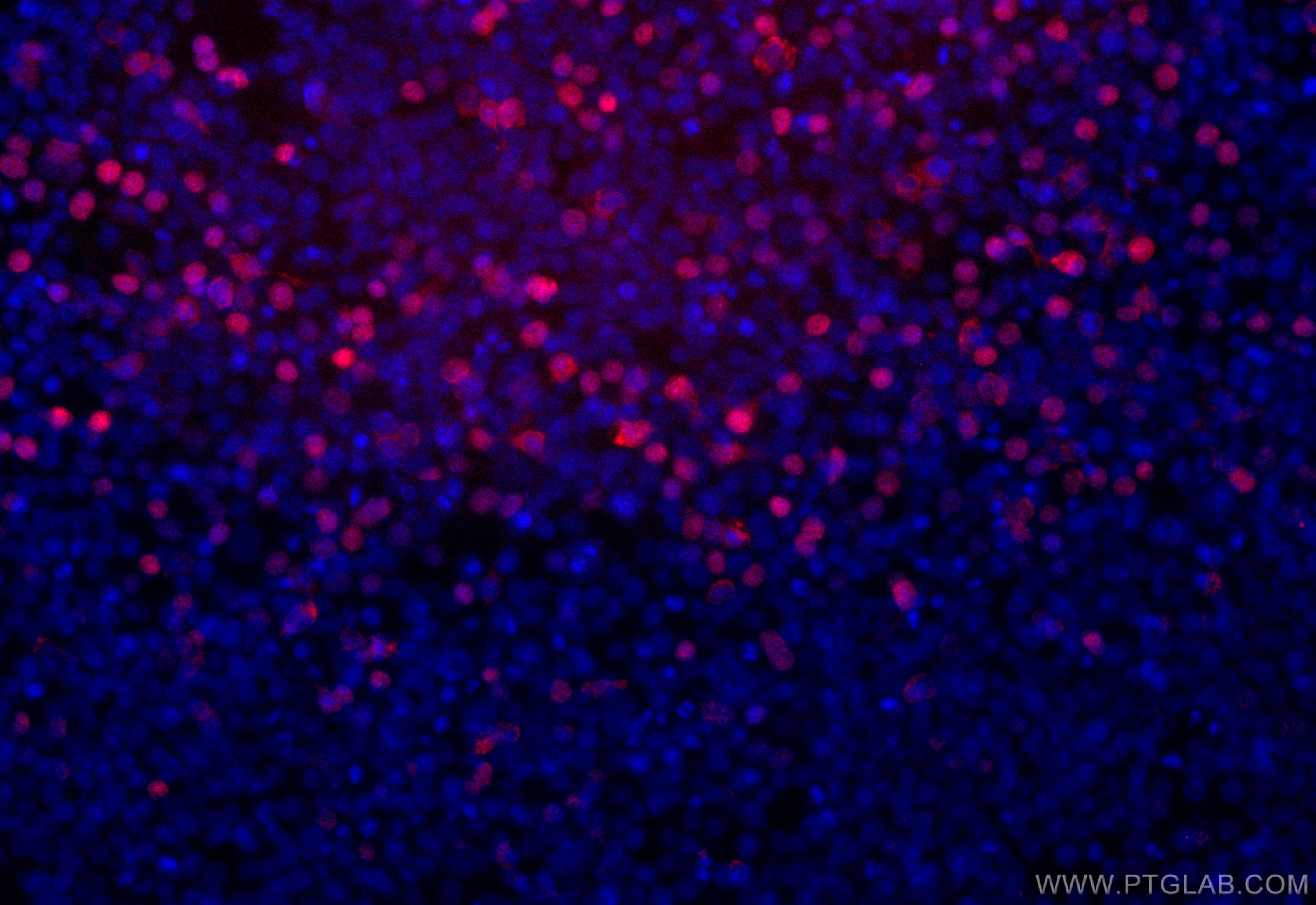 IF Staining of Transfected HEK-293 using CL594-80801-2