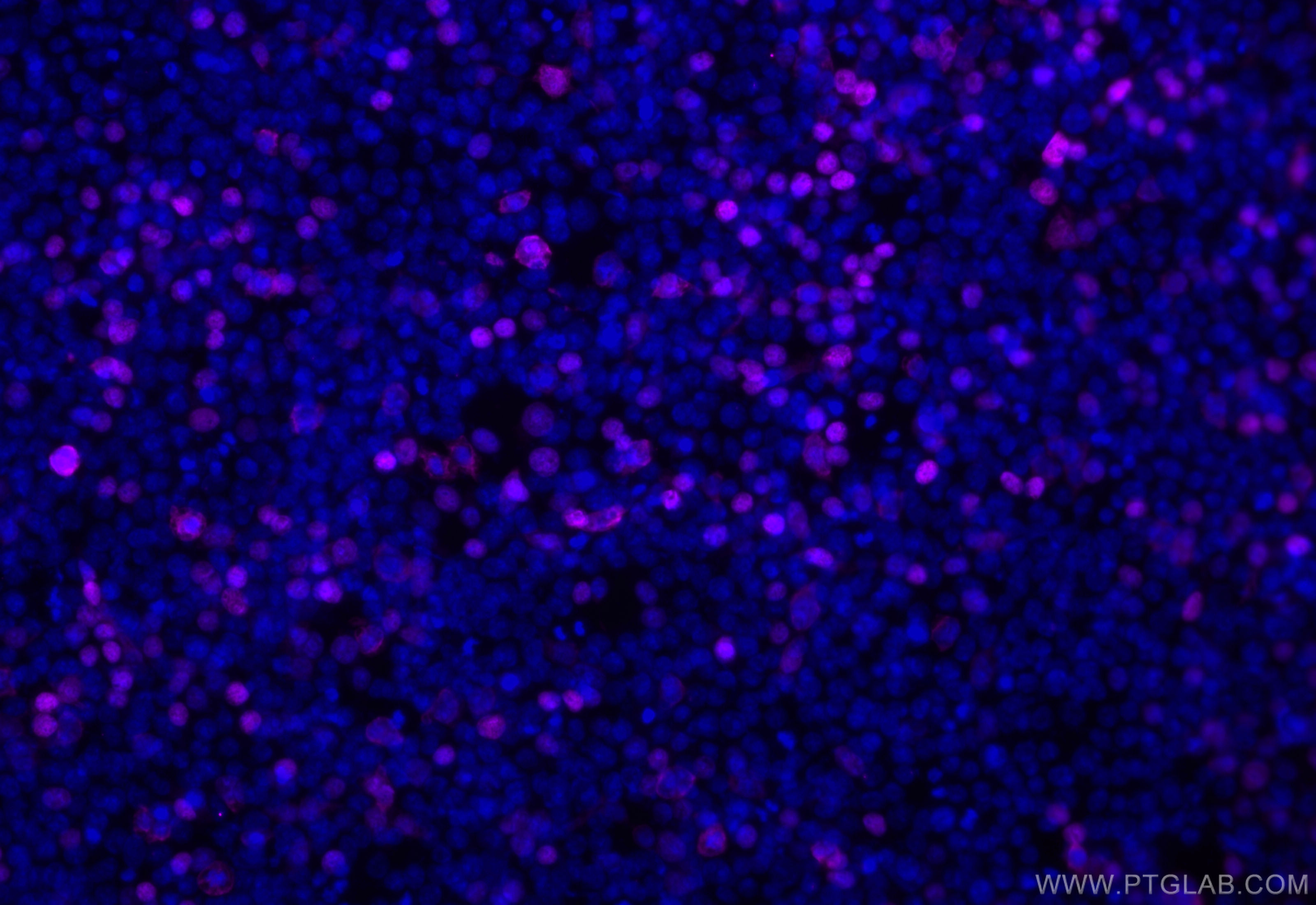 IF Staining of Transfected HEK-293 using CL647-80801-2