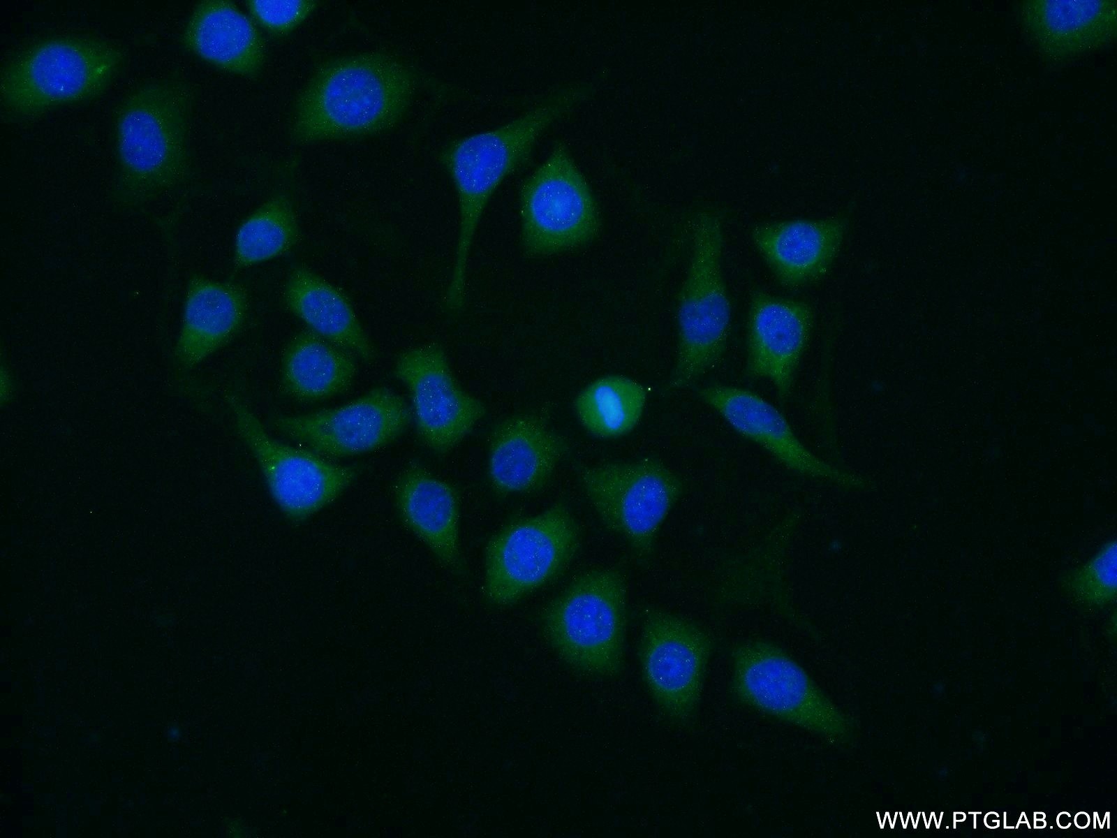 IF Staining of HeLa using 25326-1-AP